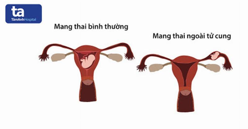 Gap bac si chuyen gia de xac dinh thai ky va tu van
